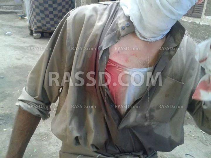 قوات الأمن تعتدي على أهالي الميمون بعد رفضهم الحملة الأمنية