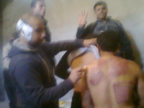 العفو الدولية: “تراجع كارثي” لحقوق الإنسان بعد الانقلاب