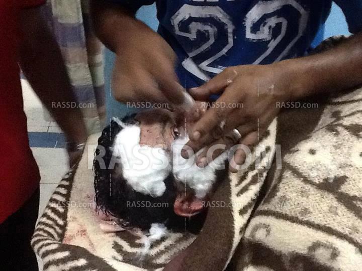 وصول أشلاء عمال الأسمنت ونداء استغاثة من مستشفى العريش