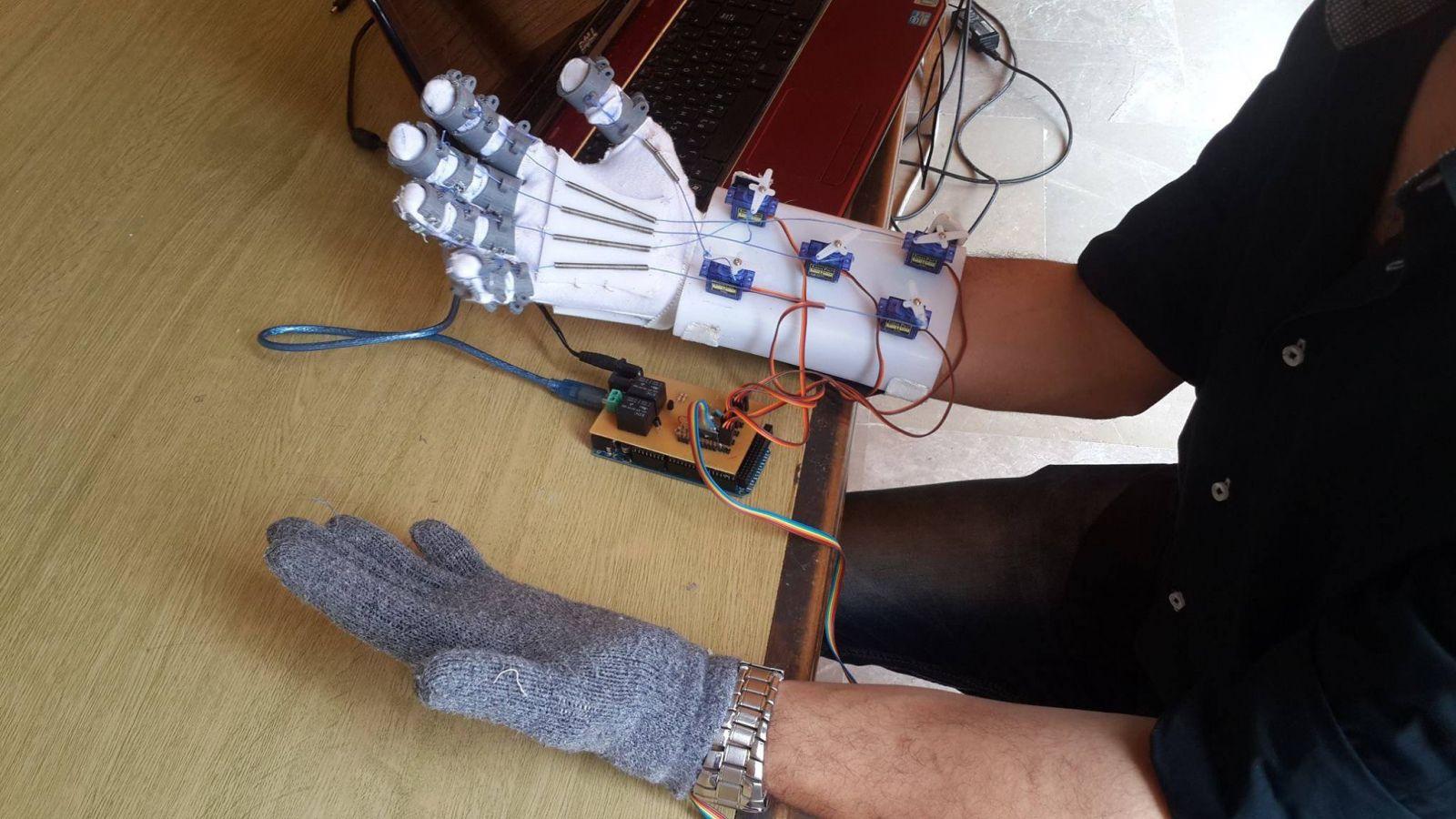 علماء روس يتوصلون إلي تقنية جديدة لإعادة الحركة إلى الأطراف المشلولة