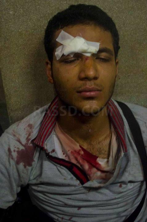 عاجل.. إصابة مراسل رصد باعتداءات البلطجية بالإسكندرية