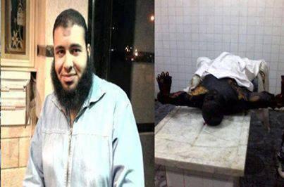 الشهيد المحترق..صورة أدمت القلوب والتهمة “ملتحي”