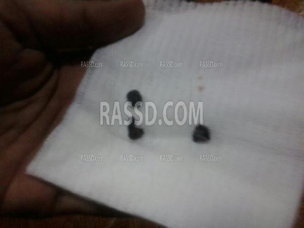 المستشفى الميداني :أجسام غريبة أصابت متظاهري “الانتاج الاعلامي”