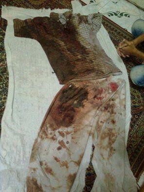 الحكم علي طالب بجامعة المنصورة عاميين وتدهور صحته بعد تعذيبه