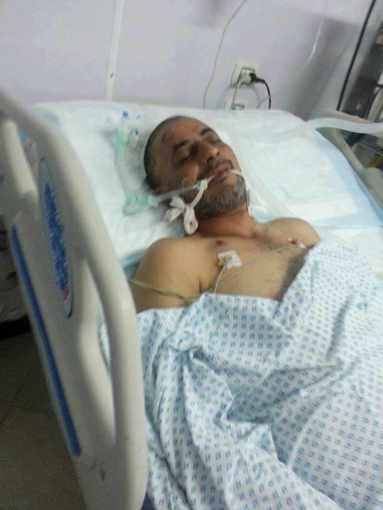 استشهاد الحالة الثانية من مصابي مسيرة بحري بالأسكندرية