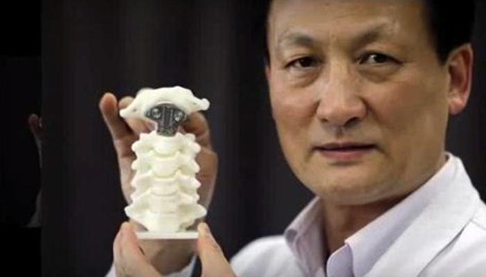 لأول مرة.. علاج آلام العمود الفقري بالطباعة 3D