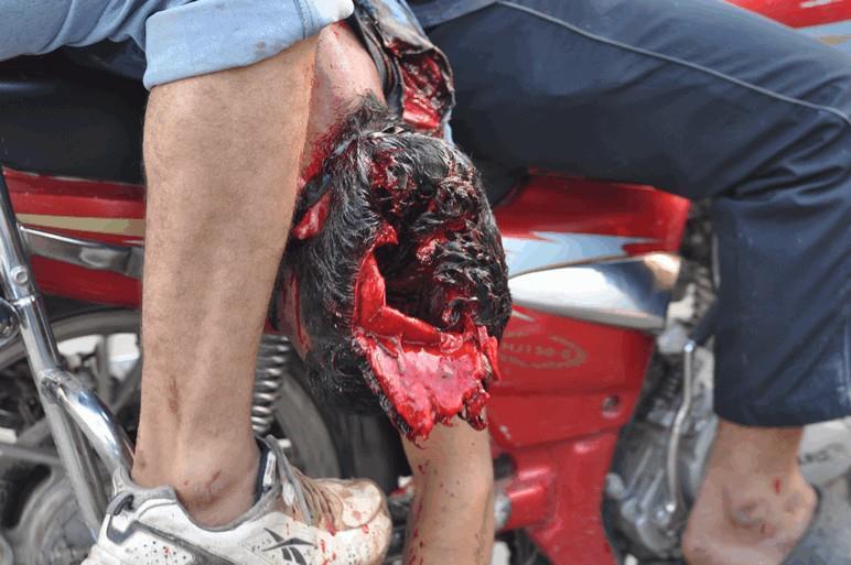 انتحار شاب لاستشهاد صديقه برابعة وندمًا على تفويض السيسي