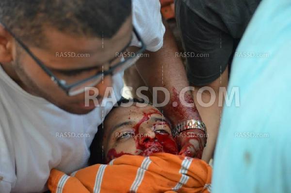 بلطجية يهاجمون مسيرة رافضة للانقلاب العسكري بالاسكندرية