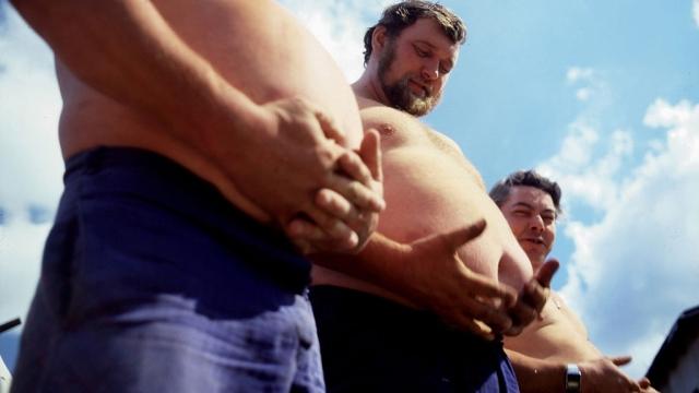 دراسة علمية: السمنة المفرطة تزيد من الإصابة بـ”السرطان”