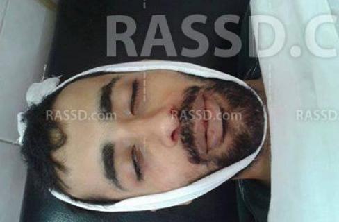 بالصور..أعتداء البلطجية والشرطةعلي مسيرة رفض الانقلاب بطنطا