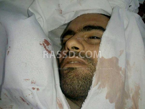 شاهد عيان:مصّور “رصد” استشهد برصاصة في الظهر خرجت من الصدر