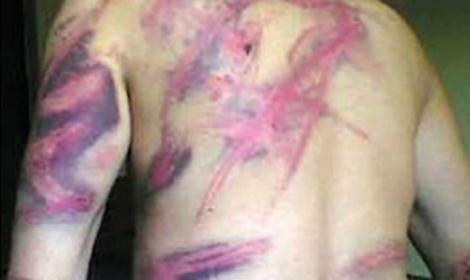 خبراء: التعذيب في السجون يضع المسئولون أمام المحاكم الدولية