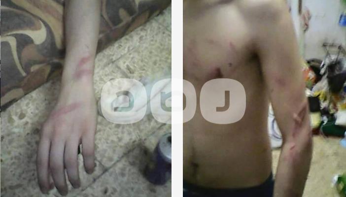 بالصور.. تعذيب المعتقلين بسجن “المستقبل” لاعتراضهم على انقطاع الماء