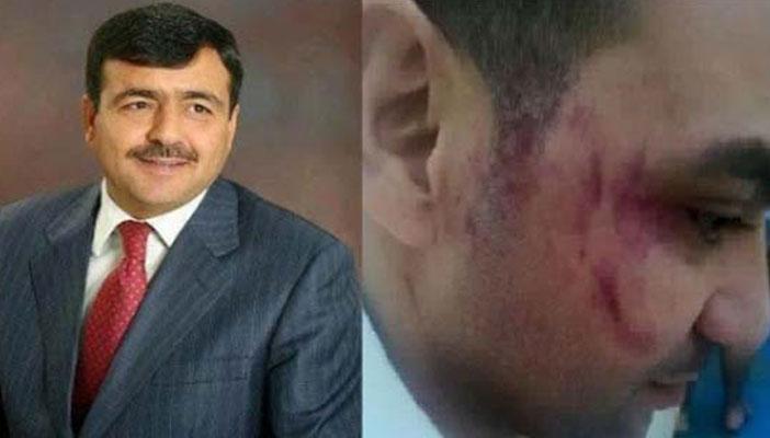 النائب الأردني مبررًا اعتداء أخيه على العامل المصري: شعر بالإهانة