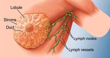 5 أطعمة لتقليل خطر الإصابة بسرطان الثدى