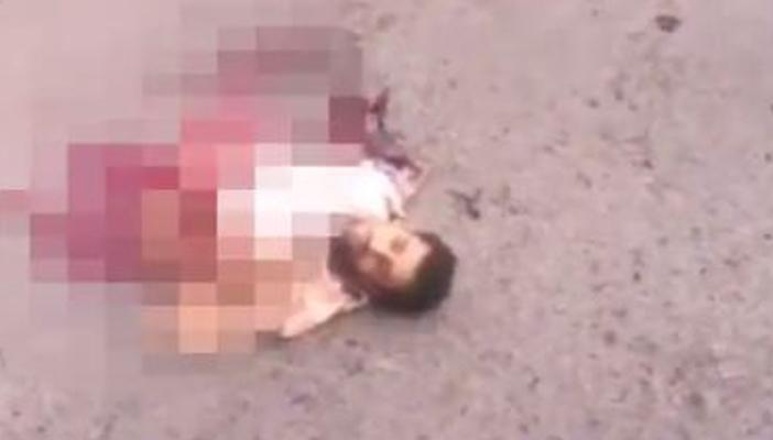 “ديلي ميل”.. بالفيديو.. انتحاري يفقد نصفه الأسفل والأعلى ما زال حيًا