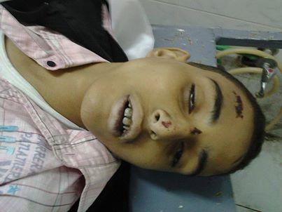 تحالف دعم الشرعية يكشف حقيقة كمين أتوبيس الإسكندرية