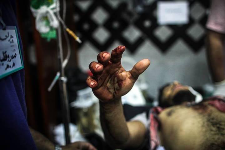 هيئة الإسعاف: قتيل وتسعة مصابين حصيلة تظاهرات اليوم