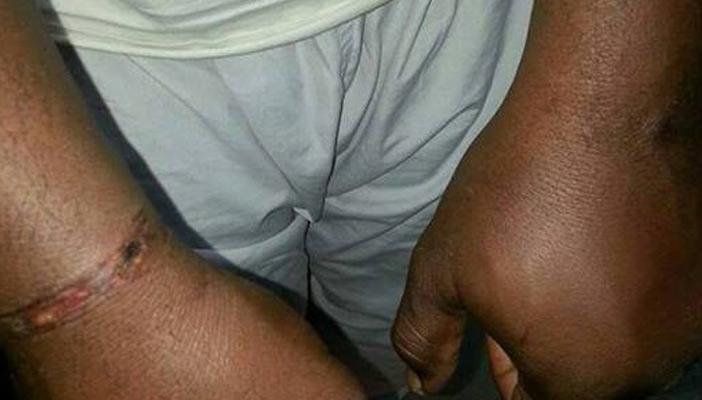 بالصور.. تفاصيل اختطاف وتعذيب الشرطة المصرية لمواطن سوداني