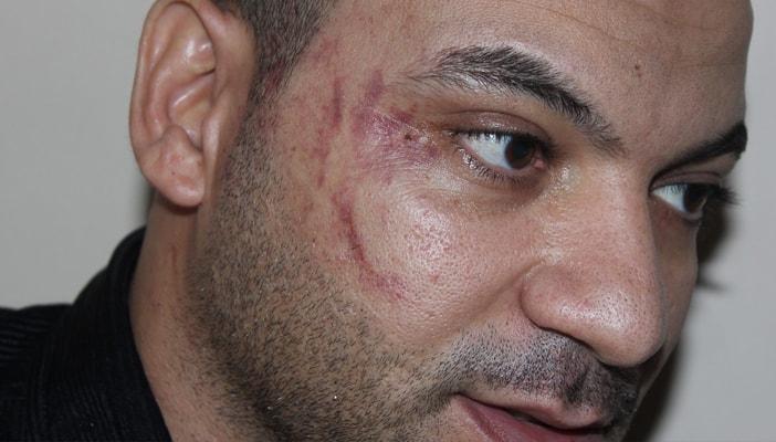 بالفيديو.. أشهر حالات الاعتداء على المصريين في الخارج خلال حكم السيسي