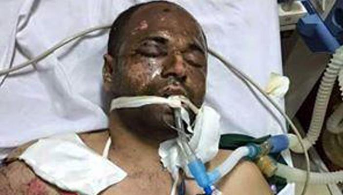 ‫دخول أحد معتقلي سجن الأبعادية في إضراب مفتوح عن الطعام