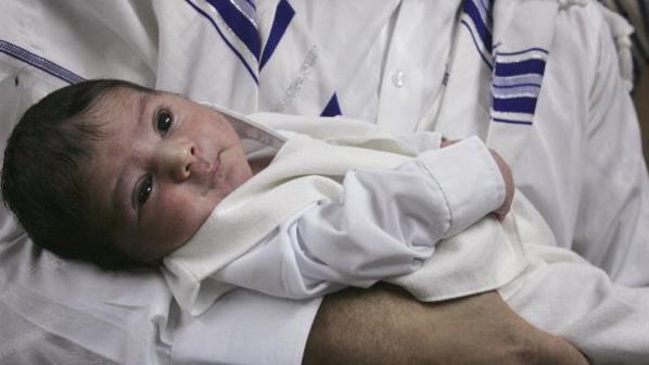 ختان الذكور يقلل من مخاطر الإصابة بمرض الإيدز