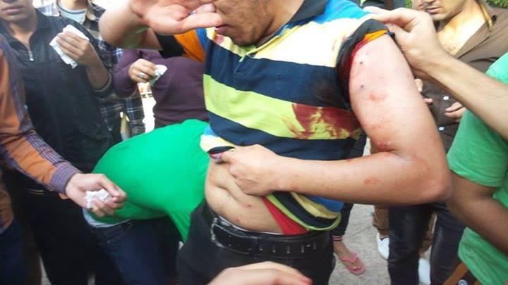 إصابة 10 بجامعة أسيوط بالخرطوش واعتقال 27