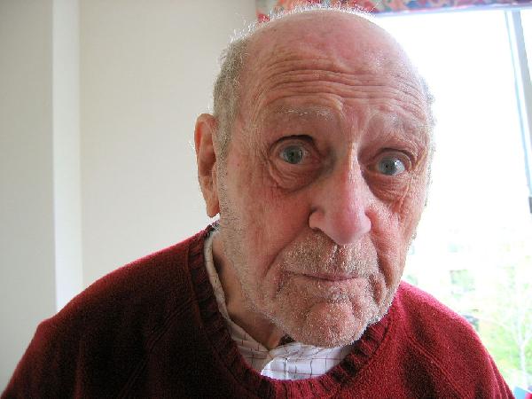 44 مليون مصاب بالزهايمر حول العالم