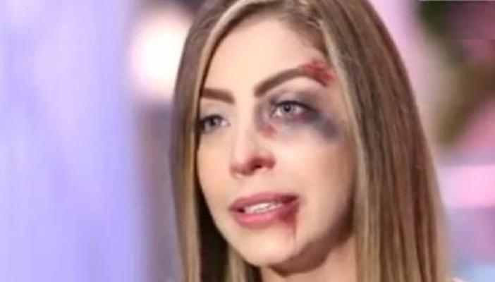 بعد ظهور المذيعة “دودي” في البانيو.. مغردون: ابتسم أنت في “ماسر”