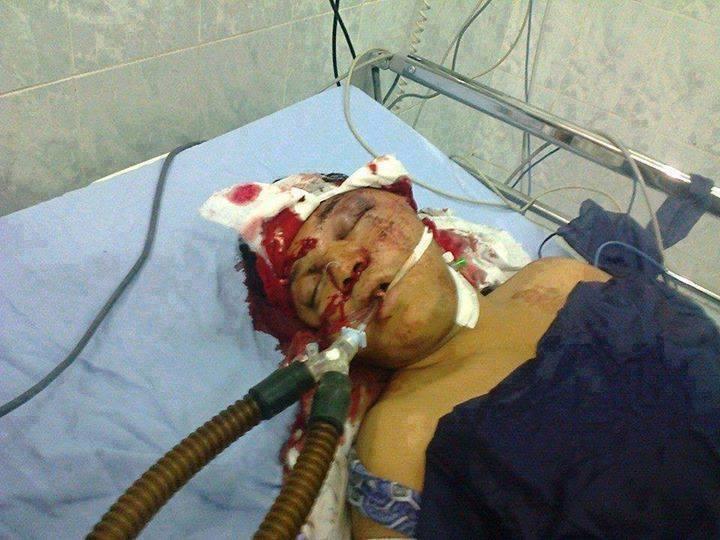 استشهاد الناشط باسم محسن بعد إصابته بطلق حي في الوجه