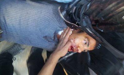 إصابة طالب بالخرطوش وتحطيم  سيارة لداخلية الانقلاب بأسيوط